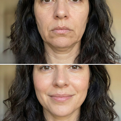 Antes y despues luminosidad